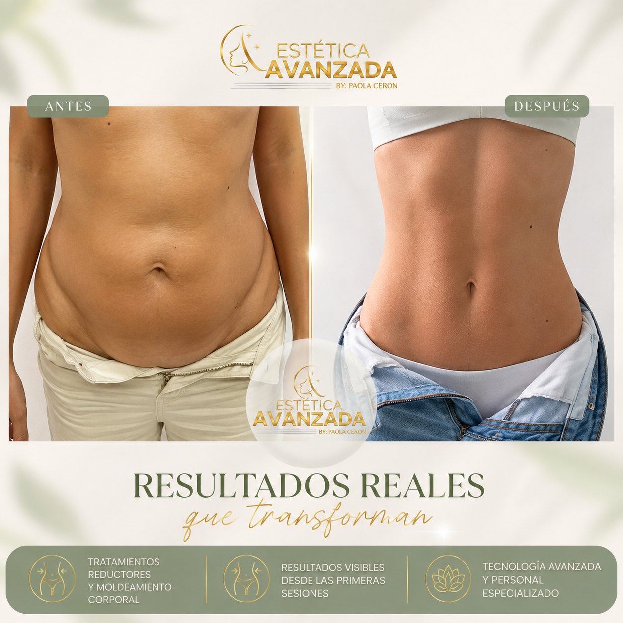 Antes y después de tratamiento corporal en abdomen